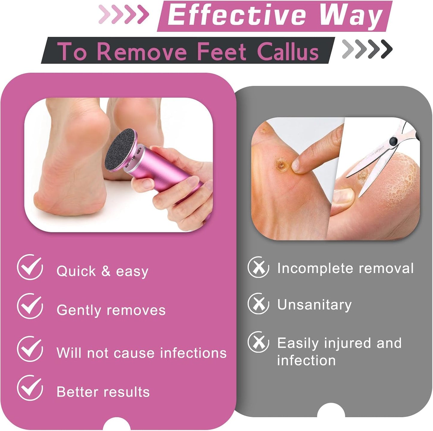 Professional Electric Callus Remover with Speed Control and 60 Replacement Sandpaper Disks - Ultimate Foot Care Tool for Smooth, Soft Feet