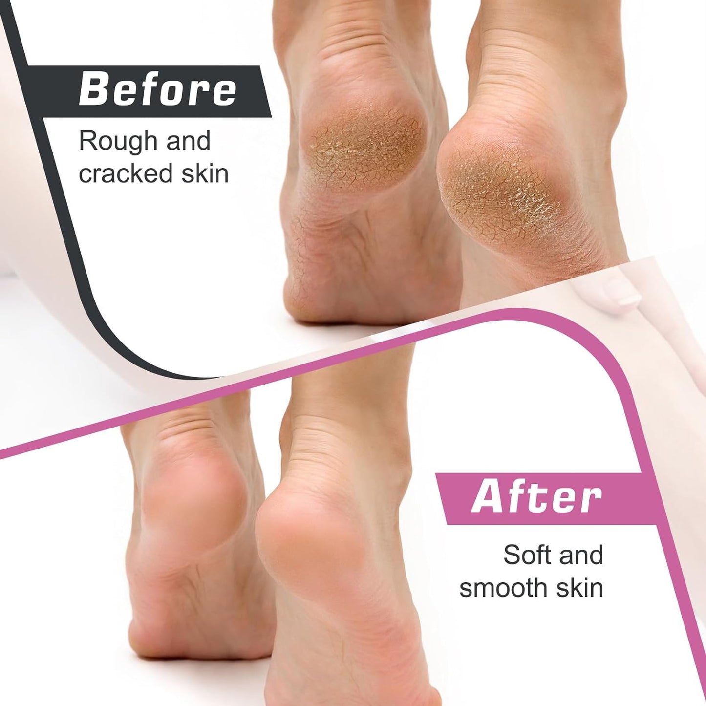 Professional Electric Callus Remover with Speed Control and 60 Replacement Sandpaper Disks - Ultimate Foot Care Tool for Smooth, Soft Feet