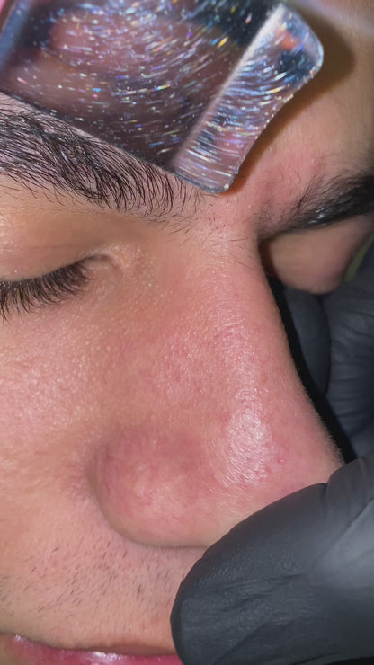 🔥 Ultrasonic Pore Cleaner - Remove Blackheads in 30 Seconds (As Seen on TikTok)